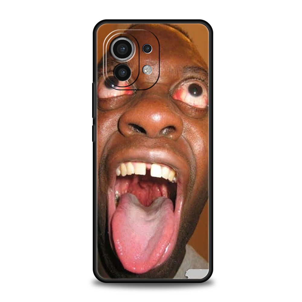 Xiaomi Poco F7 F6 F5 F4 F3 X6  - Phone Cases Ugly incelemesi ve fiyatı